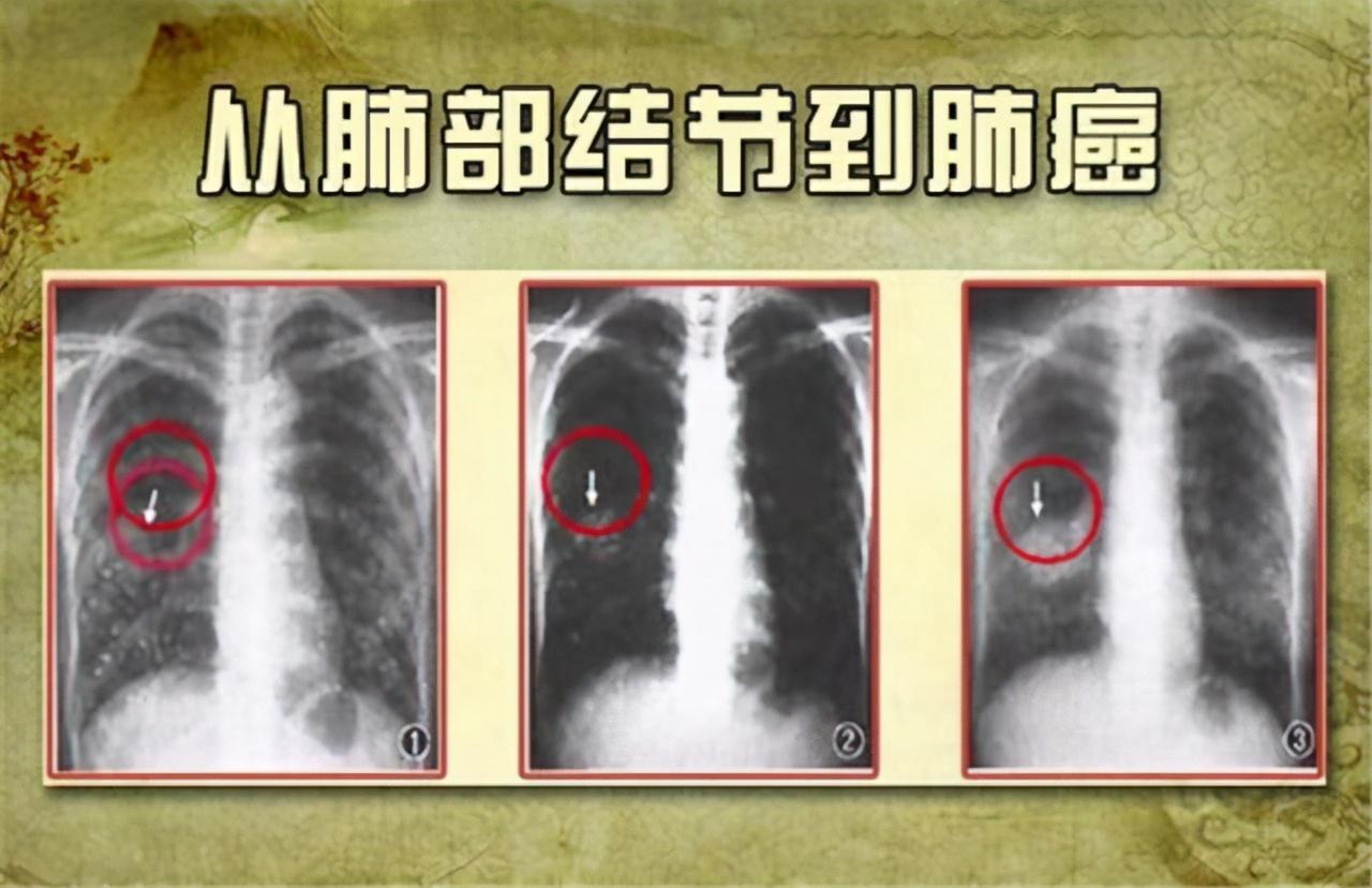 2025新澳精准正版免费大全，详细解答、构建解答解释落实